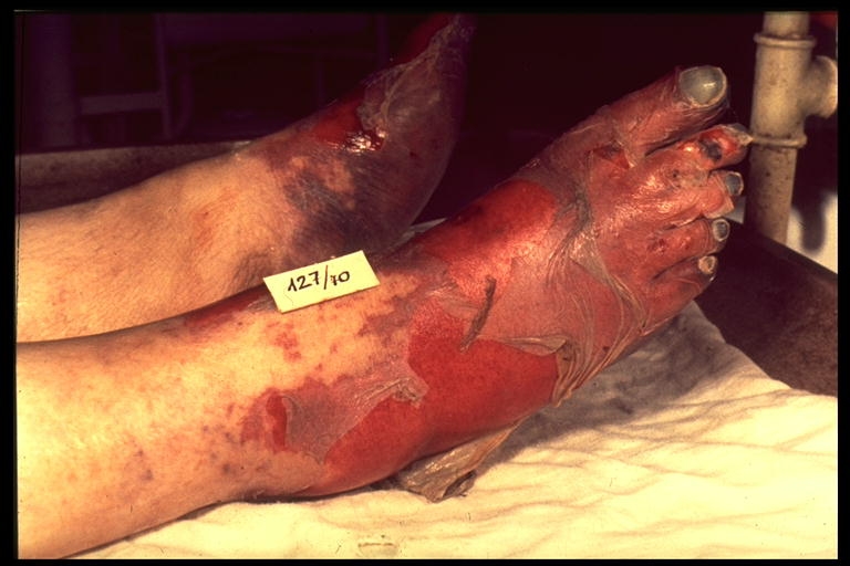 http://www.internetmonitor.lu/stopsmoking/photo/gal/pic/gal-135559.jpg
